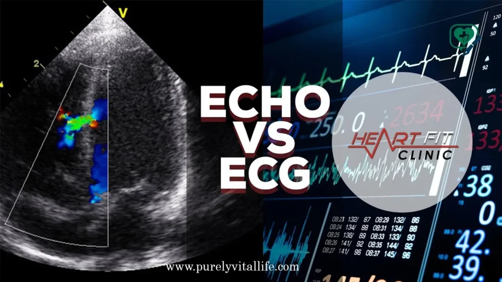 ekg vs echocardiogram