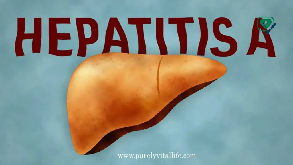 hepatitis A specialists