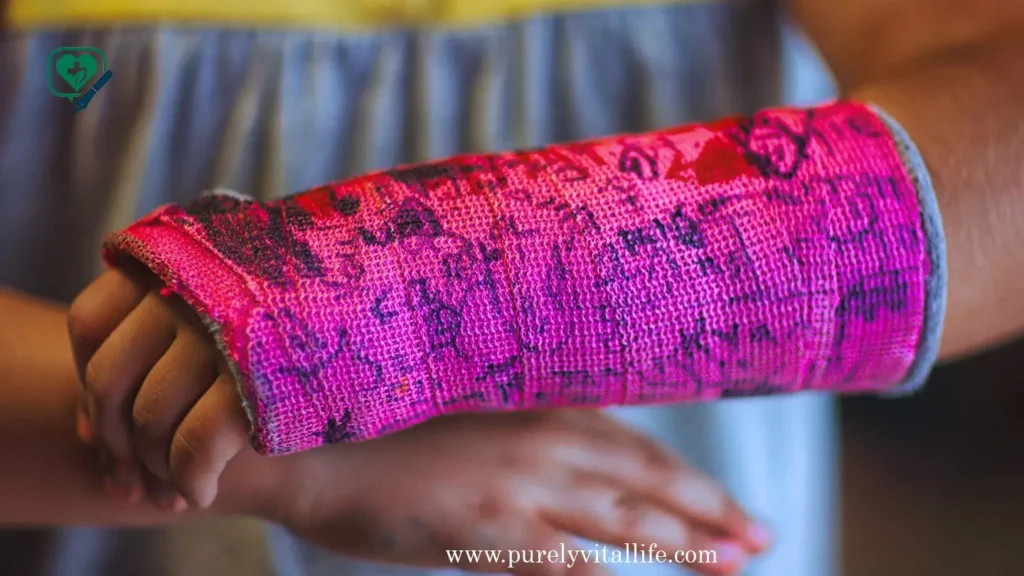 what is trans broken arm syndrome