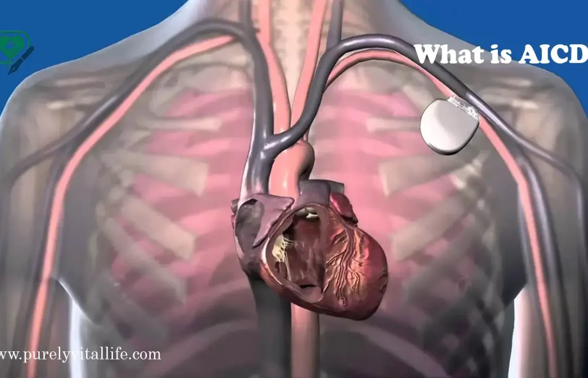 AICD Medical Abbreviation Explained: Meaning, Uses, and Importance in Cardiology
