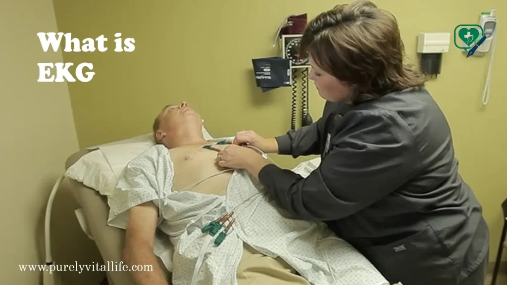 what is ekg