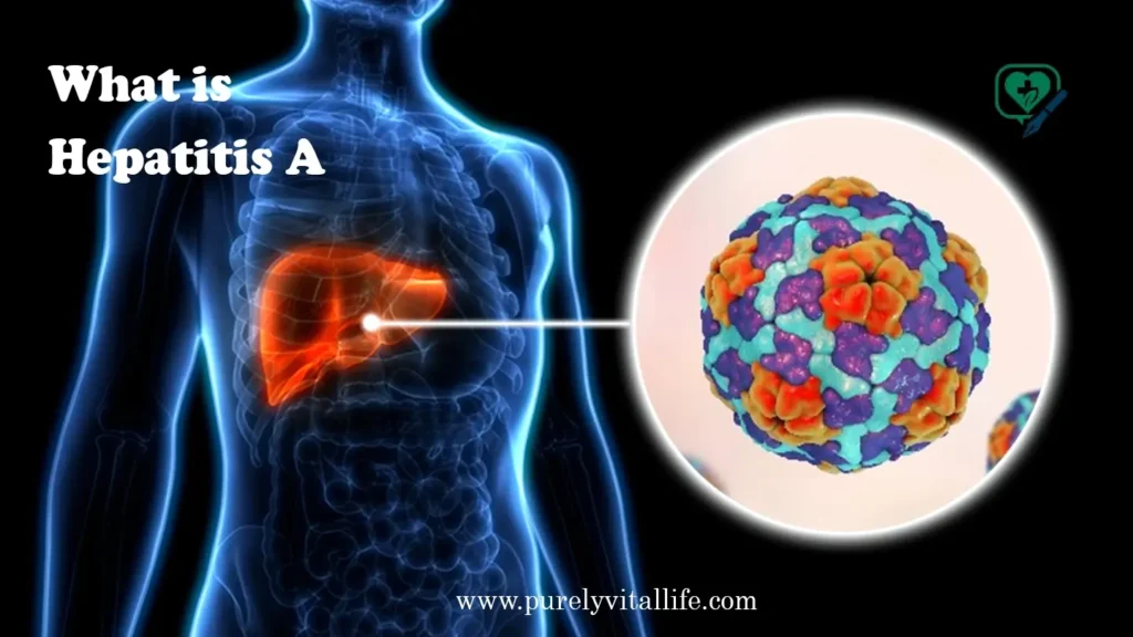 what is hepatitis a sepecialist