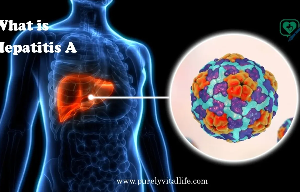 Top Hepatitis A Specialists: When and Why You Should See One