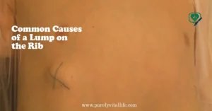 Common Causes of a Lump