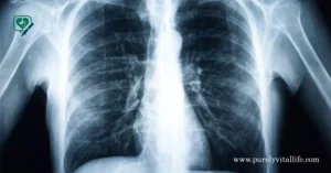 Diagnosing a lump on rib