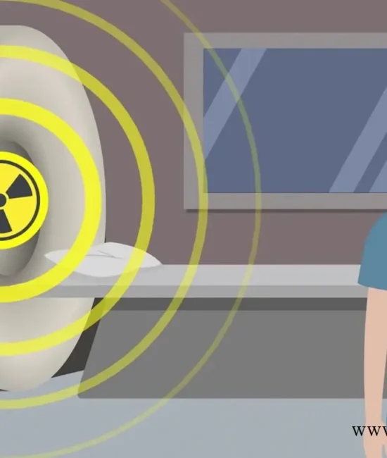 what is radiation exposure