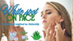 how to remove white spots on face