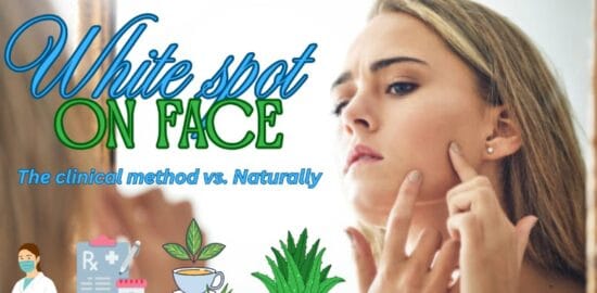 how to remove white spots on face