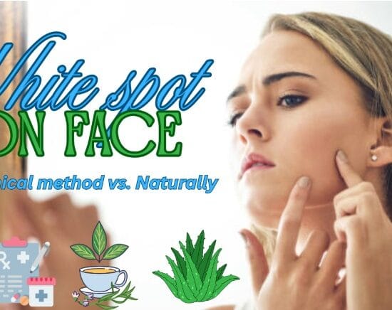 how to remove white spots on face